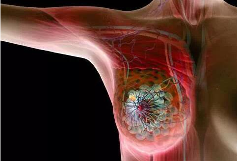 editor_1514007136276553.png 0.png