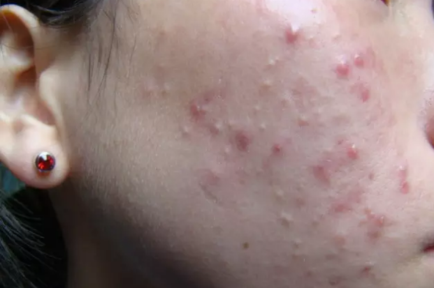 editor_1516855172222087.png 0.png