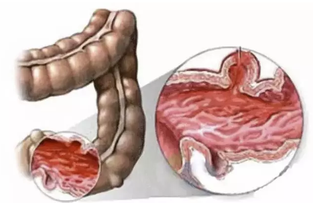 editor_1530596784615769.png 3.png