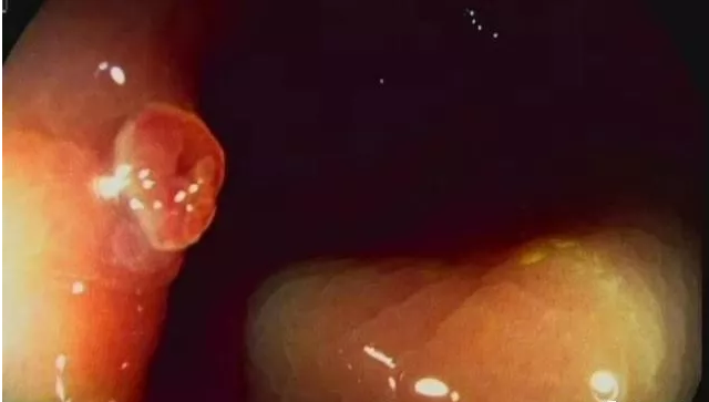 editor_1530596795444622.png 5.png