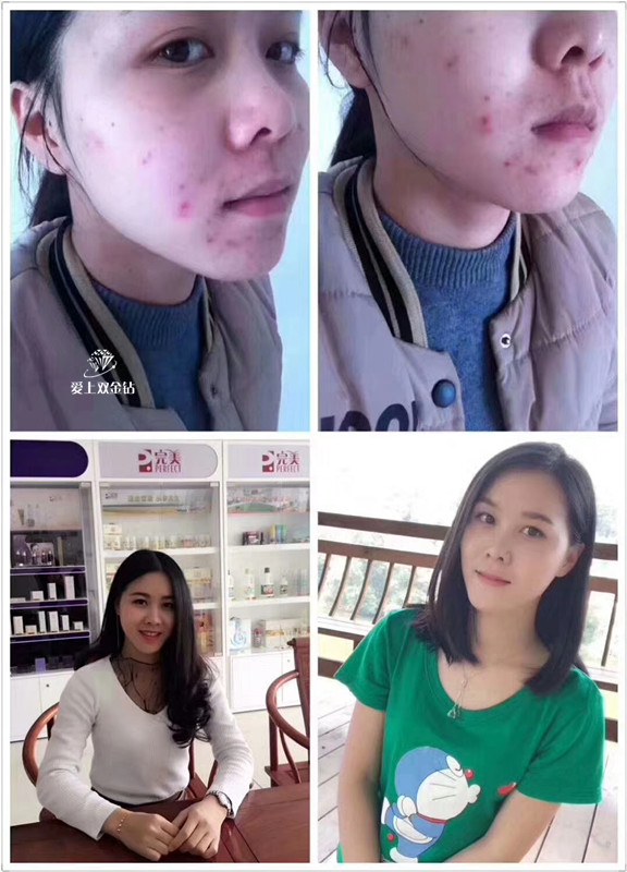 editor_1533196512369172.jpg 3.jpg