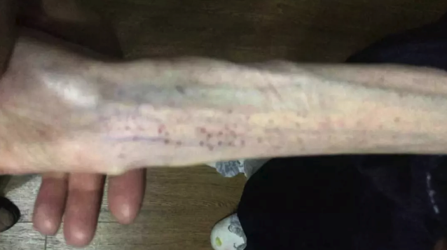 editor_1537941996926079.png 2.png